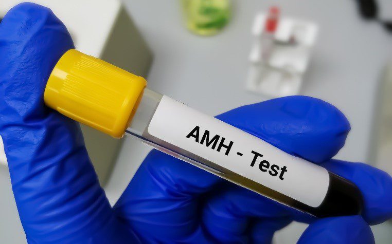 La utilidad de la hormona antimulleriana (AMH) en la predicción de la reserva funcional ovárica