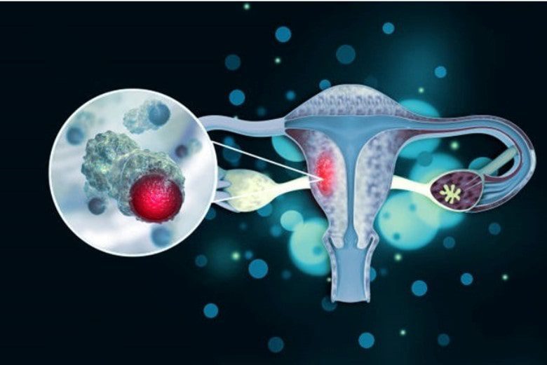 Endometrio y Técnicas de Reproducción Asistida